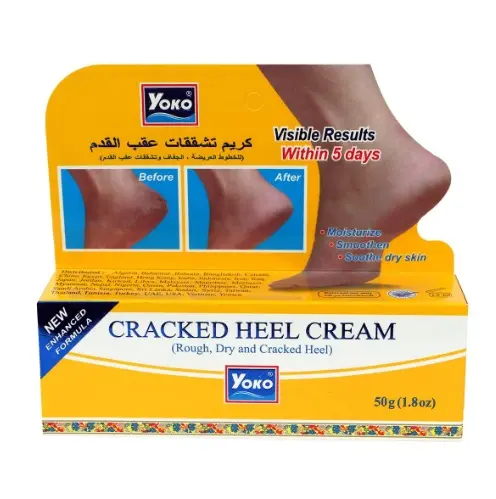 Yoko Cracked Heel Cream 50gm